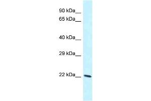 Image no. 1 for anti-Lysosomal Protein Transmembrane 4 beta (LAPTM4B) (C-Term) antibody (ABIN2774353)