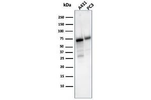 Image no. 1 for anti-5'-Nucleotidase, Ecto (CD73) (NT5E) antibody (ABIN6940227)
