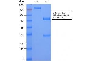 Image no. 1 for anti-Serum Amyloid A (SAA) antibody (ABIN6940563)