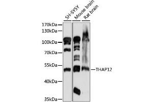 Image no. 1 for anti-Protein-Kinase, Interferon-Inducible Double Stranded RNA Dependent Inhibitor, Repressor of (p58 Repressor) (PRKRIR) antibody (ABIN6292038)