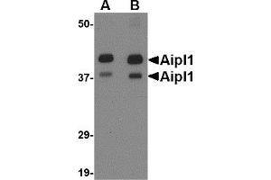 Image no. 1 for anti-Aryl Hydrocarbon Receptor Interacting Protein-Like 1 (AIPL1) (Middle Region) antibody (ABIN1030848)