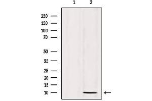 Image no. 2 for anti-serine Peptidase Inhibitor, Kazal Type 1 (SPINK1) antibody (ABIN6265260)