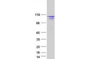 Image no. 1 for Oculocerebrorenal Syndrome of Lowe (OCRL) (Transcript Variant B) protein (Myc-DYKDDDDK Tag) (ABIN2727866)