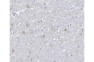 Image no. 4 for anti-Protein Phosphatase 1, Regulatory (Inhibitor) Subunit 14A (PPP1R14A) (pThr38) antibody (ABIN6256551)