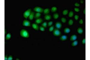 Immunofluorescent analysis of A549 cells using ABIN7156211 at dilution of 1:100 and Alexa Fluor 488-congugated AffiniPure Goat Anti-Rabbit IgG(H+L)