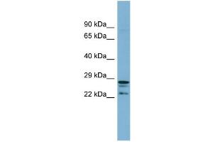 Image no. 2 for anti-CutC Copper Transporter Homolog (CUTC) (Middle Region) antibody (ABIN2786906)