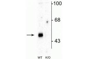 Image no. 1 for anti-gamma-aminobutyric Acid (GABA) A Receptor, alpha 2 (GABRA2) (Cytoplasmic Loop) antibody (ABIN6254102)