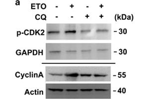Image no. 95 for anti-Glyceraldehyde-3-Phosphate Dehydrogenase (GAPDH) (Center) antibody (ABIN2857072)