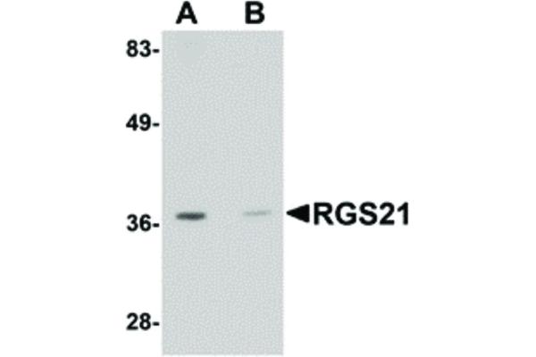 RGS21 antibody  (Internal Region)