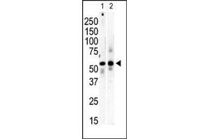 Image no. 1 for anti-Phosphatidylinositol 4-Kinase Type 2 beta (PI4K2B) (AA 305-336), (C-Term) antibody (ABIN392589)