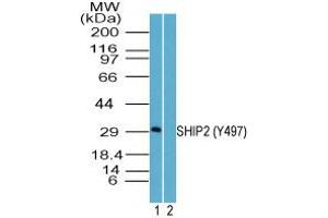 Image no. 2 for anti-Inositol Polyphosphate Phosphatase-Like 1 (INPPL1) antibody (ABIN960235)