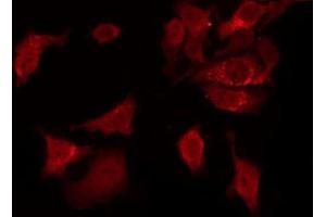 Image no. 2 for anti-Abelson Murine Leukemia Viral Oncogene Homolog 1/2 (ABL1/ABL2) (pTyr70), (pTyr89) antibody (ABIN6271428)
