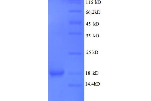 Lens Epithelial Protein (LENEP) (AA 29-164), (partial) protein (His tag)