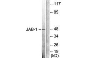 Image no. 1 for anti-COP9 Constitutive Photomorphogenic Homolog Subunit 5 (Arabidopsis) (COPS5) (AA 374-423) antibody (ABIN1533317)