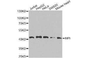 Image no. 2 for anti-Mannose Phosphate Isomerase (MPI) antibody (ABIN6143962)