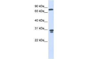 Image no. 1 for anti-Nitrilase Family, Member 2 (NIT2) (Middle Region) antibody (ABIN630973)