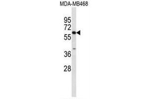 Image no. 2 for anti-Carboxylesterase 5A (CES5A) (Middle Region) antibody (ABIN951485)