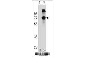 Image no. 2 for anti-Alveolar Soft Part Sarcoma Chromosome Region, Candidate 1 (ASPSCR1) (AA 65-93), (N-Term) antibody (ABIN5530303)