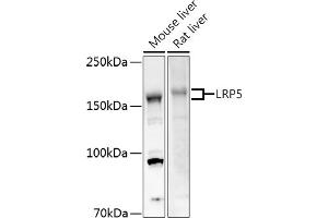 Western blot analysis of extracts of various cell lines, using LRP5 antibody (ABIN1513164, ABIN3020644, ABIN3020646 and ABIN6213630) at 1:500 dilution.