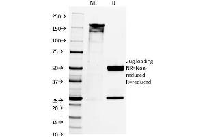 Image no. 6 for anti-Paired Box 8 (PAX8) (AA 60-261) antibody (ABIN6940924)