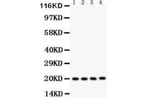 Image no. 1 for anti-Parkinson Protein 7 (PARK7) (AA 2-189) antibody (ABIN3043589)