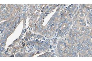 Image no. 1 for anti-Cytochrome P450, Family 11, Subfamily A, Polypeptide 1 (CYP11A1) (C-Term) antibody (ABIN6261164)