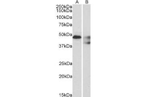 Image no. 2 for anti-Serotonin Receptor 1B (HTR1B) (C-Term) antibody (ABIN185637)