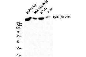 Image no. 1 for anti-Ryanodine Receptor 2 (Cardiac) (RYR2) (Tyr1018) antibody (ABIN3186859)