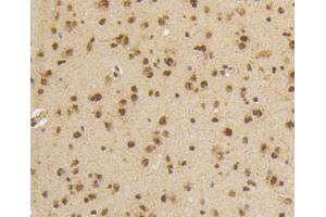 Image no. 3 for anti-SMAD, Mothers Against DPP Homolog 5 (SMAD5) (pSer463), (pSer465) antibody (ABIN5557527)