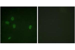 Immunofluorescence analysis of NIH-3T3 cells, using 53BP1 (Phospho-Ser25) Antibody.