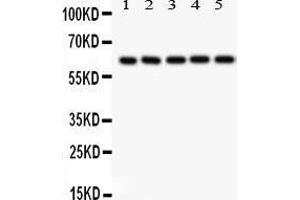 Image no. 3 for anti-SHC (Src Homology 2 Domain Containing) Transforming Protein 1 (SHC1) (AA 536-564), (C-Term) antibody (ABIN3043923)