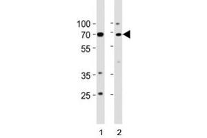Image no. 1 for anti-Tumor Protein P73 (TP73) (AA 288-317) antibody (ABIN3029400)