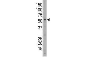 Image no. 1 for anti-Sialic Acid Binding Ig-Like Lectin 6 (SIGLEC6) (C-Term) antibody (ABIN357146)