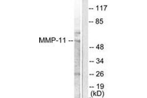 anti-Matrix Metallopeptidase 11 (Stromelysin 3) (MMP11) (AA 61-110) antibody