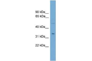 Image no. 2 for anti-Monoglyceride Lipase (MGLL) (N-Term) antibody (ABIN2784881)