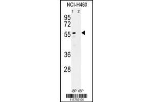 Western Blotting (WB) image for anti-Cytochrome P450, Family 3, Subfamily A, Polypeptide 4 (CYP3A4) antibody (ABIN2158457)
