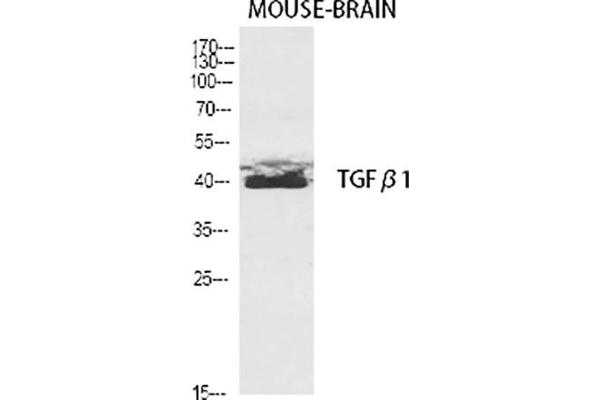TGFB1 Antikörper  (AA 310-390)