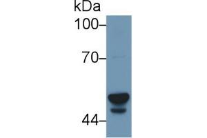 Image no. 2 for anti-Cytochrome P450, Family 3, Subfamily A, Polypeptide 7 (CYP3A7) (AA 344-497) antibody (ABIN1171793)