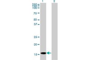 Image no. 1 for anti-Acid Phosphatase 1, Soluble (ACP1) (AA 1-158) antibody (ABIN559750)