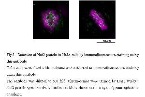 Image no. 4 for anti-NUF2, NDC80 Kinetochore Complex Component (NUF2) (C-Term) antibody (ABIN2452061)