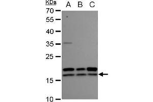Image no. 2 for anti-Nucleoside diphosphate kinase B (NME2) (Center) antibody (ABIN2854347)