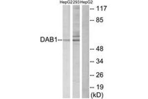 Image no. 1 for anti-Disabled Homolog 1 (Drosophila) (DAB1) (AA 199-248) antibody (ABIN1532844)