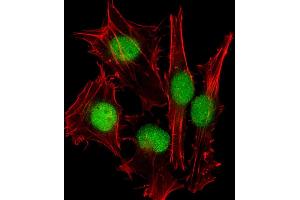 Image no. 3 for anti-Small Ubiquitin Related Modifier Protein 1 (SUMO1) antibody (ABIN387785)