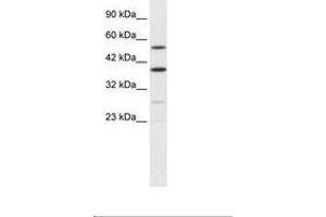 Image no. 2 for anti-A Kinase (PRKA) Anchor Protein 17A (AKAP17A) (AA 48-97) antibody (ABIN6735878)