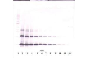 Image no. 3 for anti-Interleukin 3 (IL-3) antibody (ABIN465873)