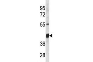 Image no. 2 for anti-Thioredoxin Interacting Protein (TXNIP) (AA 116-145) antibody (ABIN3029123)