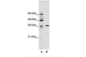 Image no. 1 for anti-Zinc Finger Protein 124 (ZNF124) (N-Term) antibody (ABIN202167)