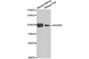 Image no. 1 for anti-ADAM Metallopeptidase Domain 9 (ADAM9) antibody (ABIN1876576)