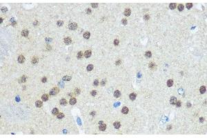 Immunohistochemistry of paraffin-embedded Mouse brain using UBA1 Polyclonal Antibody at dilution of 1:100 (40x lens).