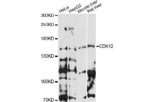 Image no. 1 for anti-Cdc2-Related Kinase, Arginine/serine-Rich (CRKRS) antibody (ABIN6291897)